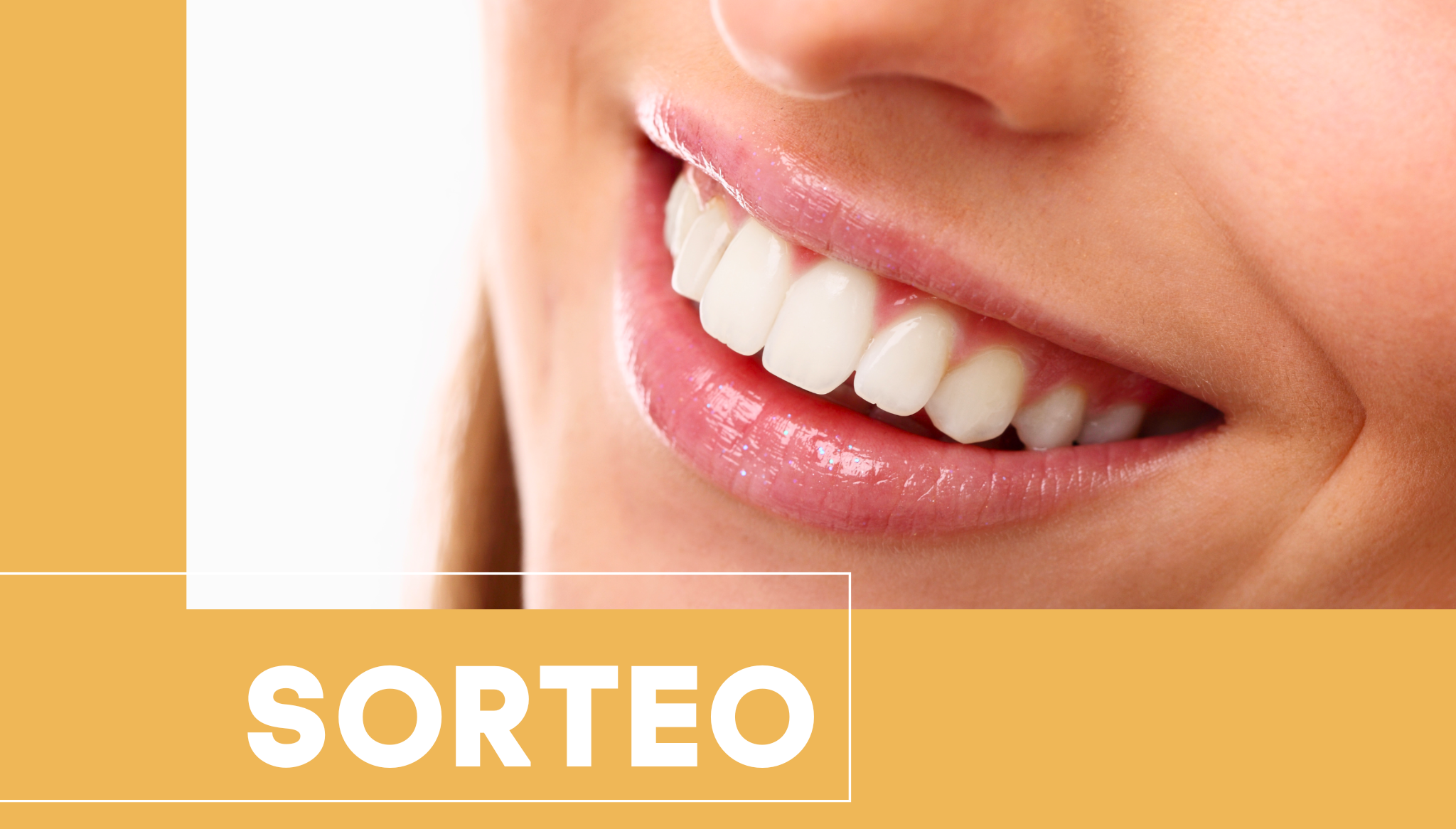 Sorteo Blanqueamiento y limpieza en Clínica Dental Puchol